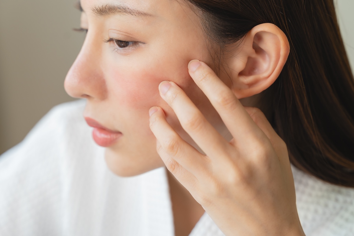 Young woman looking in mirror with a red facial rash caused by skin inflammation