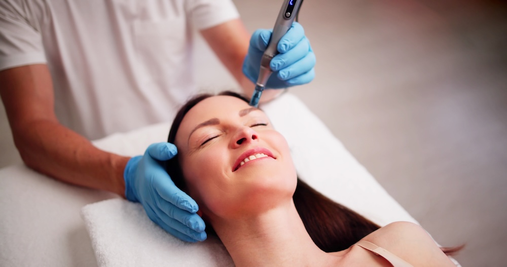 Client receiving a professional microneedling treatment, illustrating the growing slow-ageing trend among UK beauty consumers in 2025.