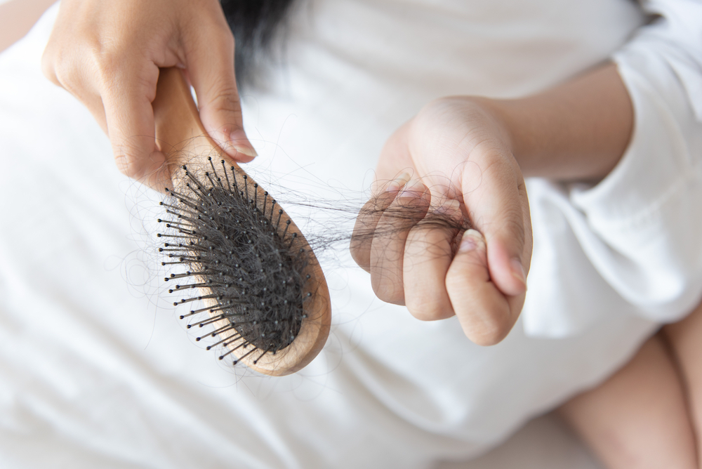 Person holding a hair brush with signs of hair shedding visible, hair on the brush