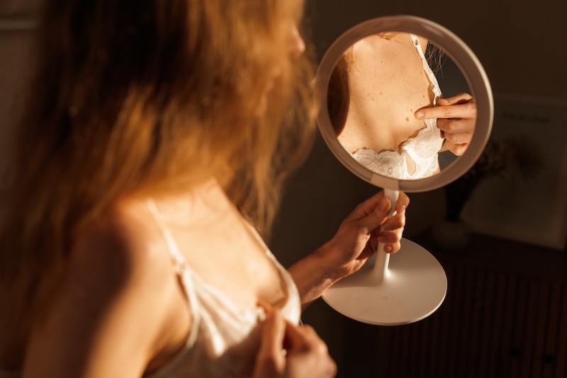 Woman examining a mole on her chest to check for possible signs of skin cancer and melanoma awareness.
