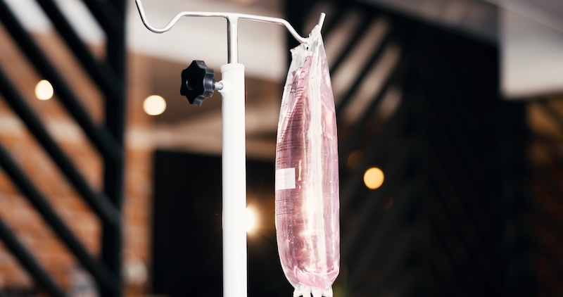 IV drip bag hanging in a clinical treatment room before intravenous therapy administration.