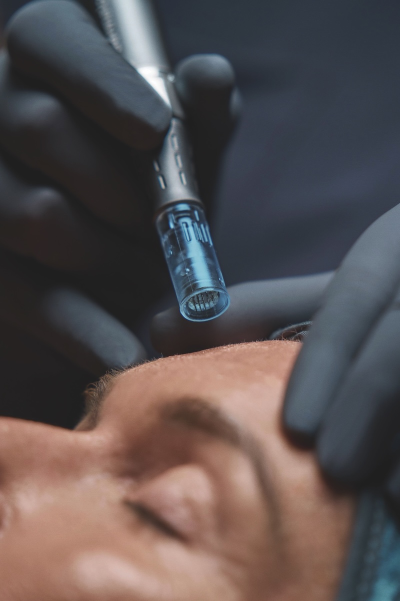 Close-up of Dermalogica's professional microneedling pen used for advanced skin treatments and featured in the Sharp Standards Guide