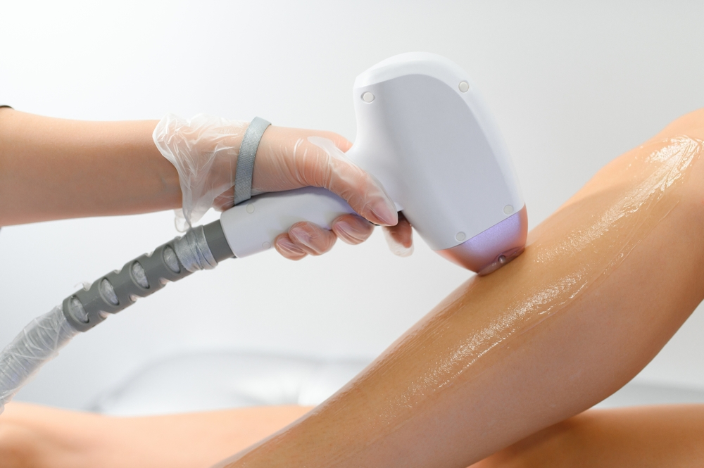 Laser hair removal treatment being performed on a patient's leg using a handheld device